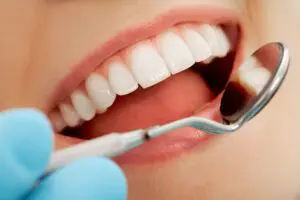invisalign treatments
