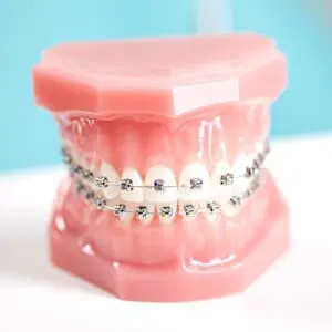 braces